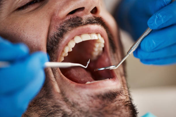 Best Emergency Dental Services for Seniors in La Presa, CA