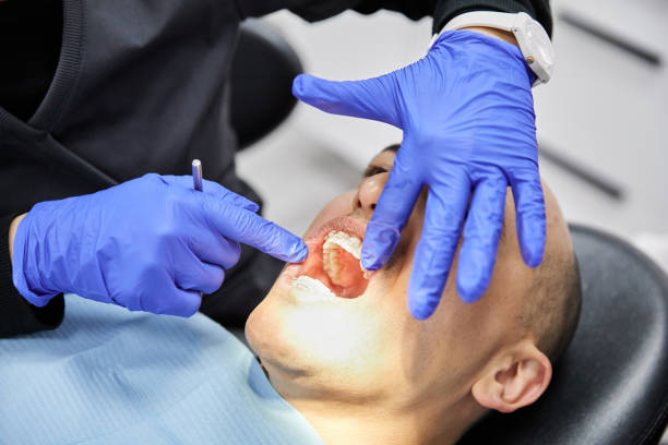Best Emergency Dentist for Lost Fillings or Crowns in La Presa, CA